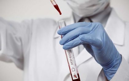 Três Lagoas tem 33 novos casos positivos para COVID-19