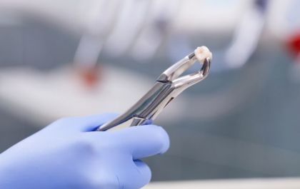 Qual a hora certa para fazer a retirada dos dentes do siso? - Quem esclarece o assunto é a equipe da Crodonto TL
