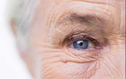 Catarata nos olhos, qual a hora certa para operar?- Quem esclarece o assunto é equipe médica do IOTL