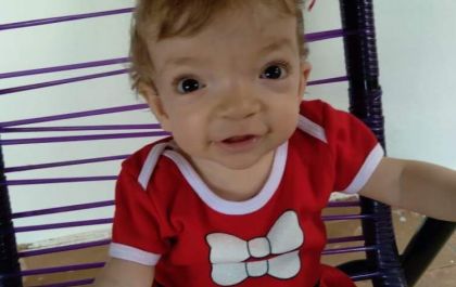 Mãe corre contra o tempo para conseguir realizar cirurgia da filha de 1 ano
