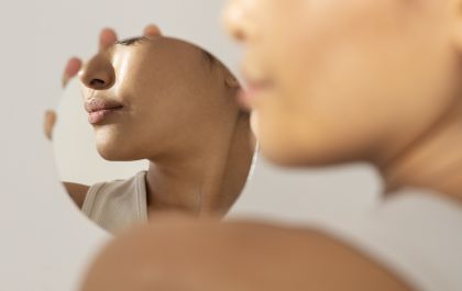 Melasma: a marca do rosto das brasileiras