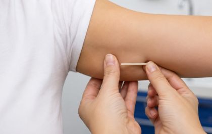 Anvisa aprova ampliação do uso do Implanon para cinco anos