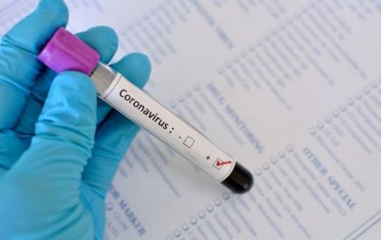Em Três Lagoas 103 casos testam positivo para COVID-19